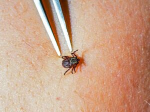 Lyme disease